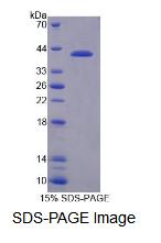 Recombinant Nuclear Receptor Corepressor 1 (NCOR1)