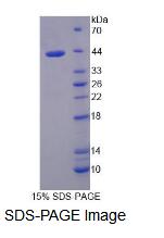 Recombinant Transcriptional Intermediary Factor 1 Beta (TIF1b)