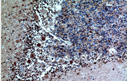 Cystatin C Mouse Monoclonal Antibody(5A2)