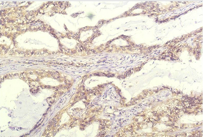 IL-8 Mouse Monoclonal Antibody(13F8)