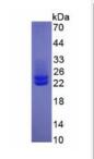 Active Interleukin 6 (IL6)