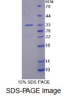 Recombinant Bromodomain Containing Protein 2 (BRD2)