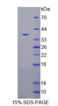 Recombinant Calsequestrin 2 (CASQ2)