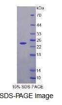 Recombinant Fibronectin Leucine Rich Transmembrane Protein 1 (FLRT1)