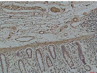 Galectin-3 Monoclonal Antibody