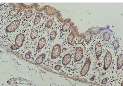 HDAC1 Mouse Monoclonal Antibody(4E1)