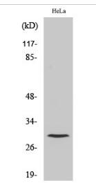 Cleaved-Cathepsin L1 HC (T288) Polyclonal Antibody