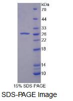 Recombinant Ubiquitin Specific Peptidase 2 (USP2)