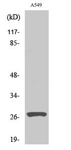 Cleaved-Cathepsin D HC (L169) Polyclonal Antibody