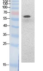 NFκB-p65 (Acetyl Lys314/Lys315) Polyclonal Antibody