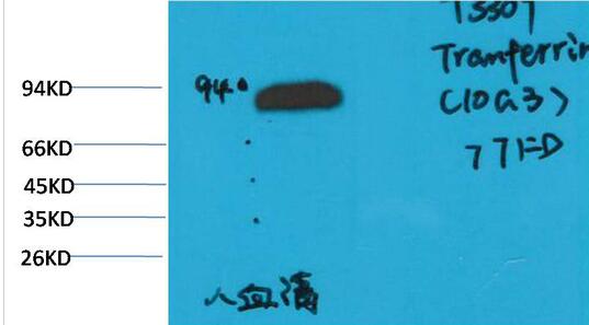 Transferrin Monoclonal Antibody
