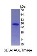 Eukaryotic Tissue Inhibitors Of Metalloproteinase 2 (TIMP2)