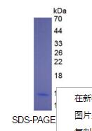 Eukaryotic Interleukin 8 (IL8)