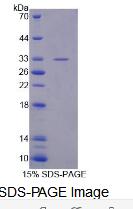 Recombinant Exportin 4 (XPO4)