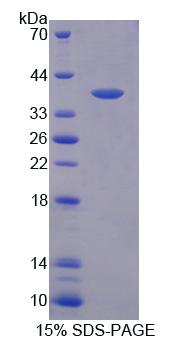 Recombinant Peroxisomal Biogenesis Factor 19 (PEX19)