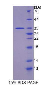 Recombinant Growth Factor Receptor Bound Protein 14 (Grb14)