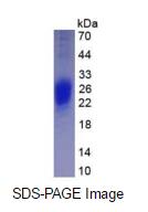 Eukaryotic Interferon Gamma (IFNg)