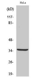 Cleaved-Cathepsin L2 (L114) Polyclonal Antibody