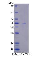 Recombinant Ubiquitin Specific Peptidase 2 (USP2)