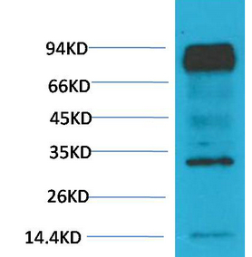 HIF-1 β/ARNT Monoclonal Antibody