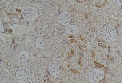 Kir4.1 Polyclonal Antibody