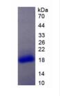 Active Interleukin 17 Receptor A (IL17RA)