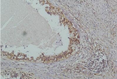 IκB β Monoclonal Antibody