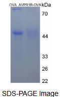 OVA Conjugated Arginine Vasopressin Receptor 1B (AVPR1B)