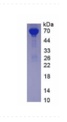 Native Albumin (ALB)