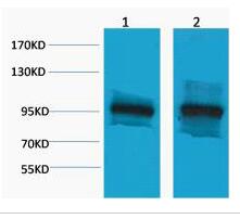 β-Catenin Polyclonal Antibody