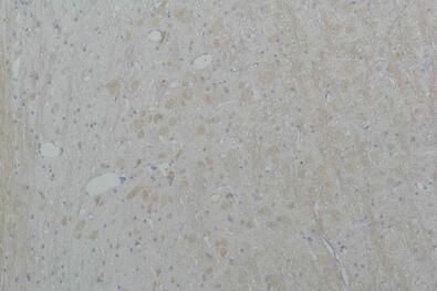 Cav2.2 Polyclonal Antibody