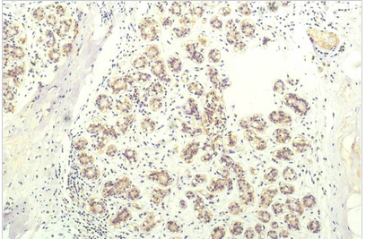 STAT1 Mouse Monoclonal Antibody(5H7)