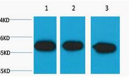 β III tubulin Monoclonal Antibody