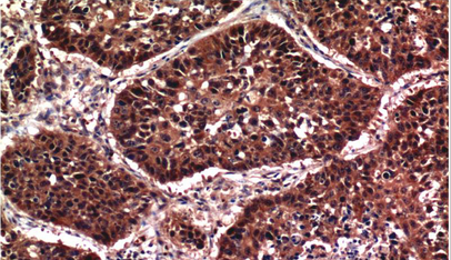 Phospho-Akt (S473) Mouse Monoclonal Antibody(7F9)