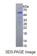 Eukaryotic High Mobility Group Protein 1 (HMG1)