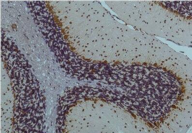 CaMKIIβ/γ/δ (Phospho Thr287) Monoclonal Antibody
