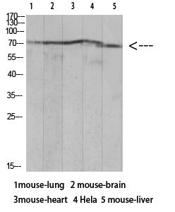 Ku-70 (Acetyl Lys317) Polyclonal Antibody