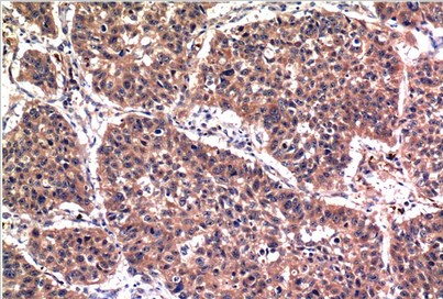 Phospho-Akt (S473) Mouse Monoclonal Antibody(6F8)
