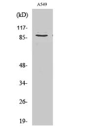 Cleaved-COL3A1 (G1221) Polyclonal Antibody