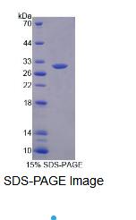 Recombinant Mediator Complex Subunit 8 (MED8)