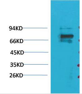 Kv1.5 Polyclonal Antibody