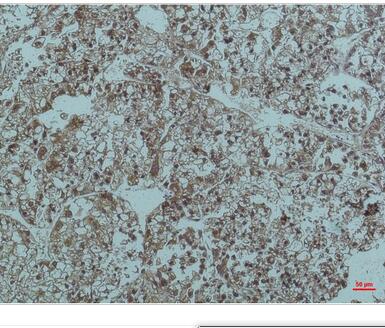 Smad3 Monoclonal Antibody
