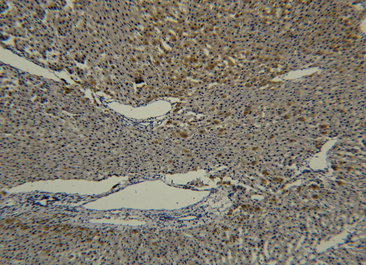 Transferrin Monoclonal Antibody