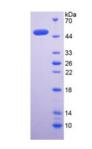 Active Histidine Rich Glycoprotein (HRG)