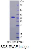 Recombinant G-Elongation Factor, Mitochondrial 2 (GFM2)