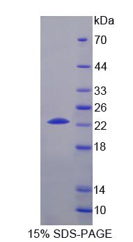 Recombinant Choline Kinase Beta (CHKb)