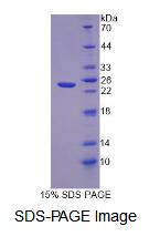 Recombinant Fibronectin Leucine Rich Transmembrane Protein 1 (FLRT1)