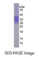 Eukaryotic Erythropoietin (EPO)