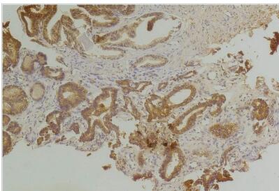 Endothelin B Receptor Polyclonal Antibody