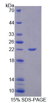 Recombinant Xeroderma Pigmentosum, Complementation Group B (XPB)